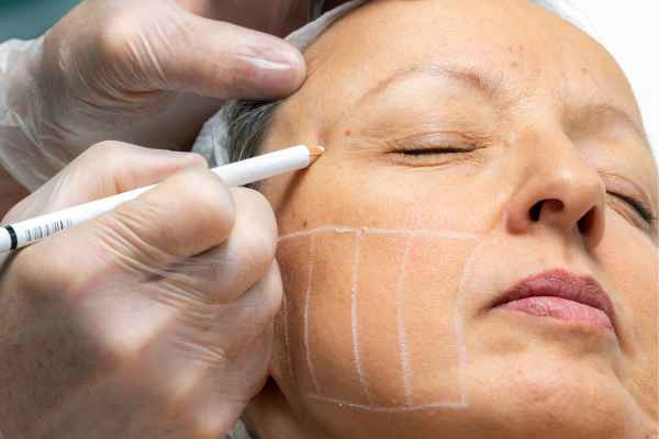 CryoPen: 5 Skin Concerns It May Be Used to Treat 4 What should you ask before having CryoPen treatment Birmingham?