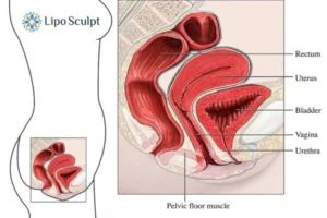 Treatment For A Leaky Bladder 2 How EM Chair treatment Birmingham can help Leaky bladder issues. Read more now!