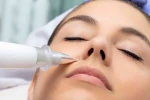 Best Actinic Keratoses Removal 3 Actinic keratoses Birmingham solutions - book in today!