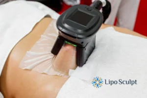 Does Fat Freezing At Home Work? 3 Fat freezing at home from Lipo Sculpt Birmingham